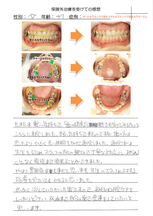 201306_shibi_TY.jpg