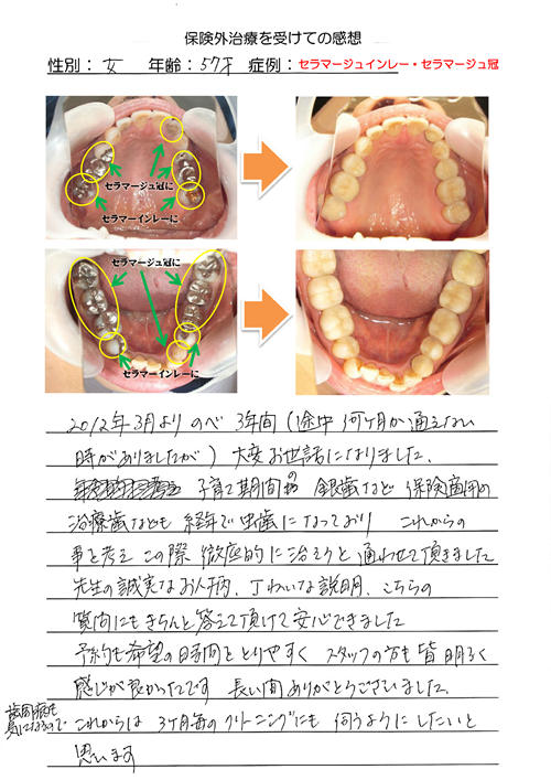 s-20150428_07MI.png