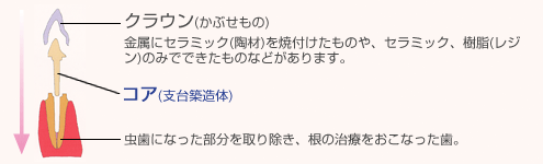 コア(土台)とは？