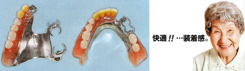 装着間が良く、人にやさしいチタン床義歯