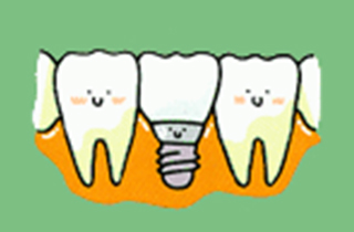 数本のインプラントを入れて入れ歯の固定源となる維持装置を取り付けます。