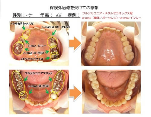 症例写真の画像