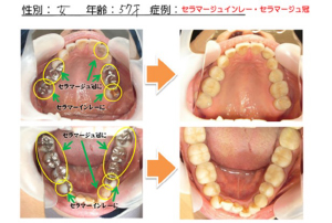 セラマージュ 〜 CERAMAGE